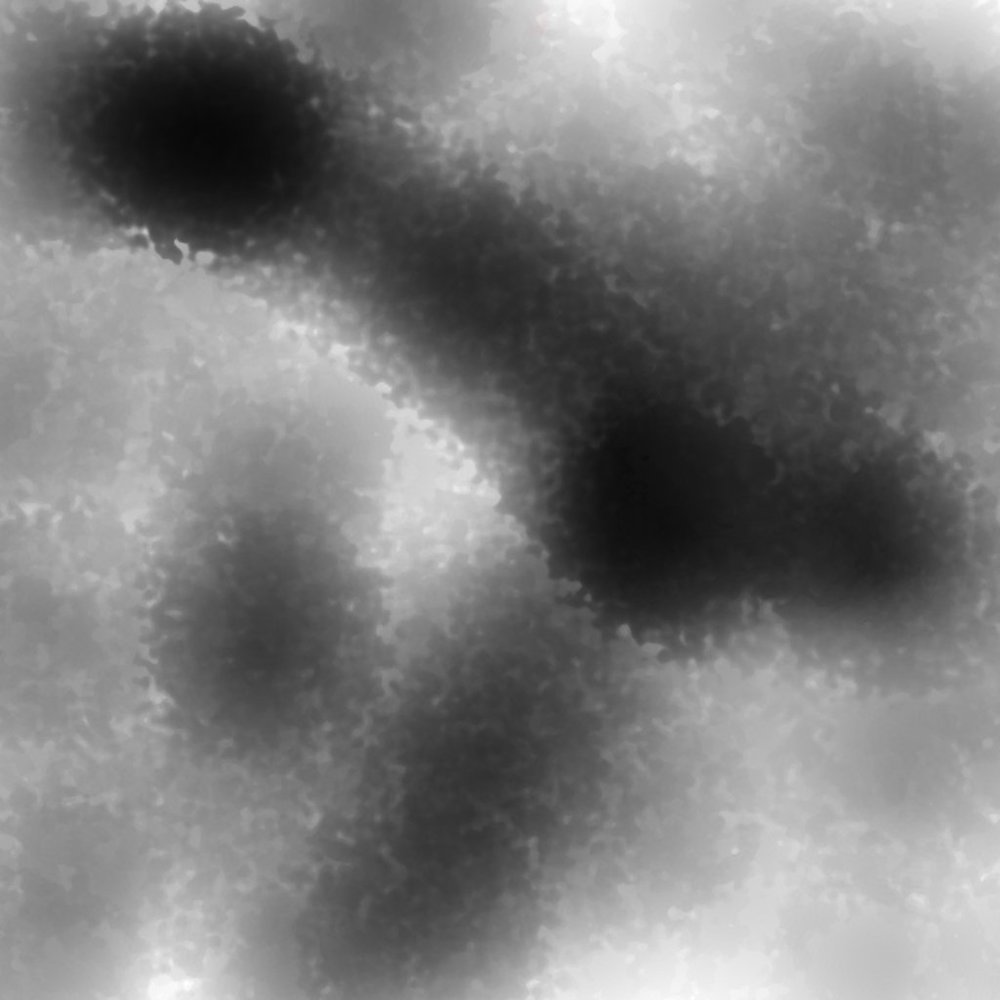 Meet your Posher, Suzette